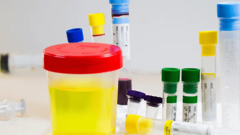 Different Types Of Drug Tests